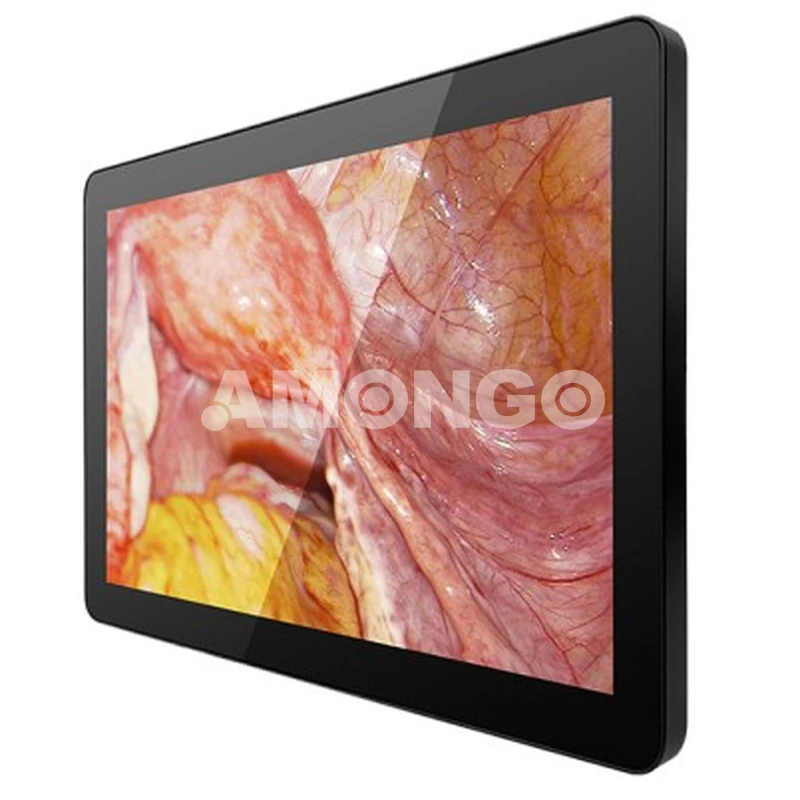 شركة تصنيع شاشات طبية AMG 15OPTD01G1